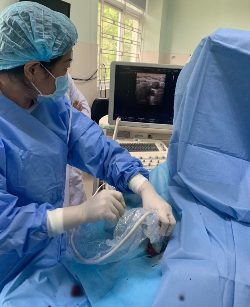 Kỹ thuật tiên tiến tạo "đường hầm" lọc máu cho bệnh nhân suy thận 1 05f4797fe2