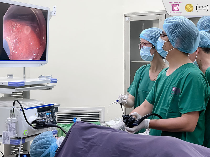 Điều trị ung thư sớm ở dạ dày bằng nội soi 1 1d5357007a