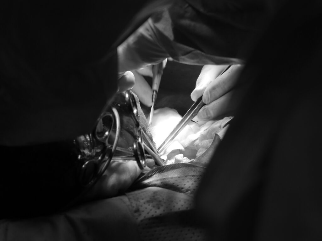 Phẫu thuật thành công, cắt khối u xơ tử cung gần 4 kg 1 db6e8fccd4