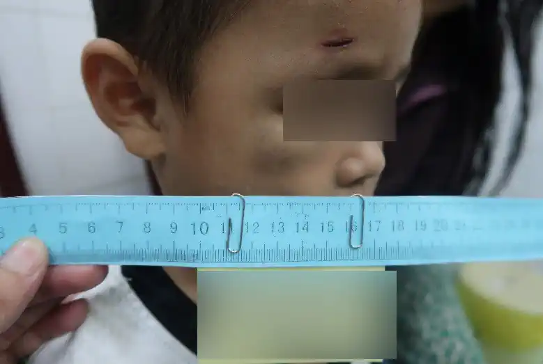 Bảo vệ trẻ em trước vấn nạn bạo hành 1 1bb98902a0