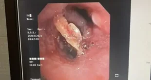 1709290228 660x330.webp