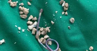 1721516877 660x330.webp