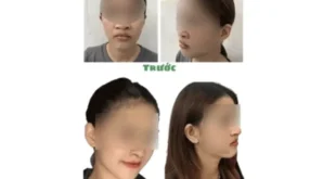 1723779906 660x330.webp