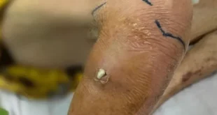 1723798029 660x330.webp