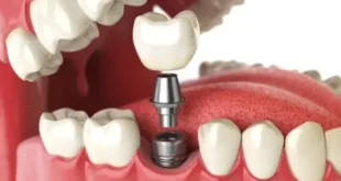 1726730114 660x330.webp