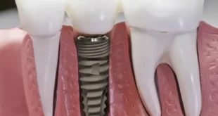 1729507031 660x330.webp