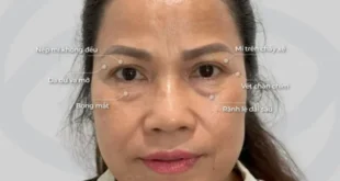 1732675343 660x330.webp