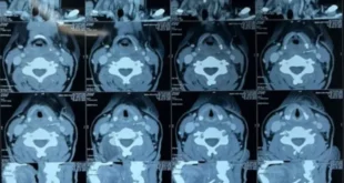 1733388167 660x330.webp